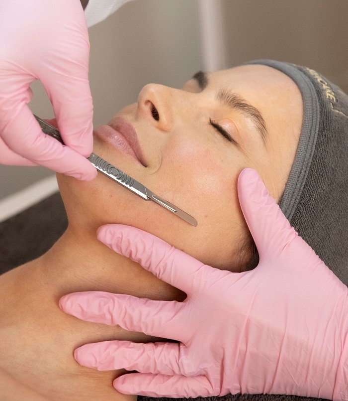 Dermaplaning Services Portland